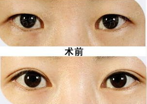 开汽车眼睛视力多少