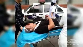 汽车撞人骨折赔多少