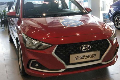 宁波现代汽车首付多少