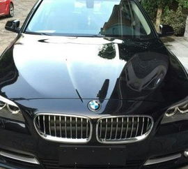 宝马520汽车包围多少